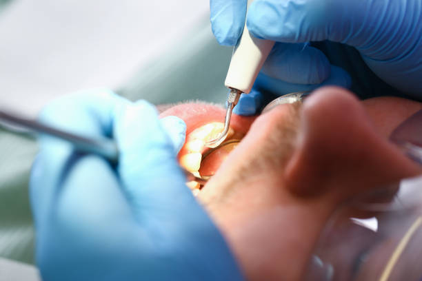 Best Emergency Dentist for Lost Fillings or Crowns in Ladue, MO